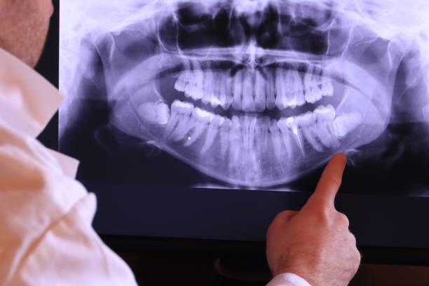 Best Emergency Cosmetic Dentistry (e.g., broken veneers) in Chatmoss, VA